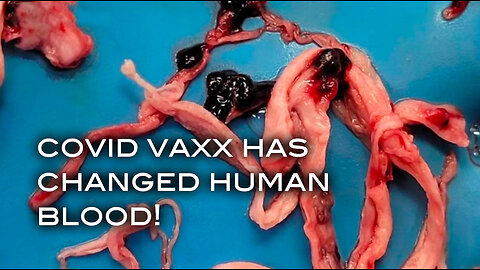 Covid Vaxx Has Changed Human Blood!