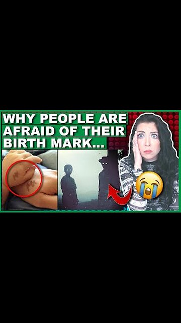 Birthmark Theory #theory #fyp #LearnOnTikTok #mystery #satisfying #birthmark