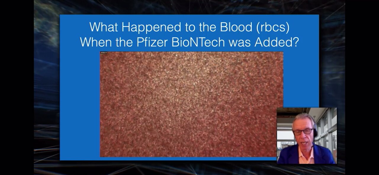 Dr Fleming : What Happens When the Pfizer Vaccine is Added to Human Blood.