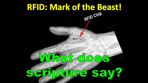 MARK OF THE BEAST RFID CHIP WILL BRING IN A CASHLESS SOCIETY BEFORE WW3. 🕎Revelation 20:4 KJV