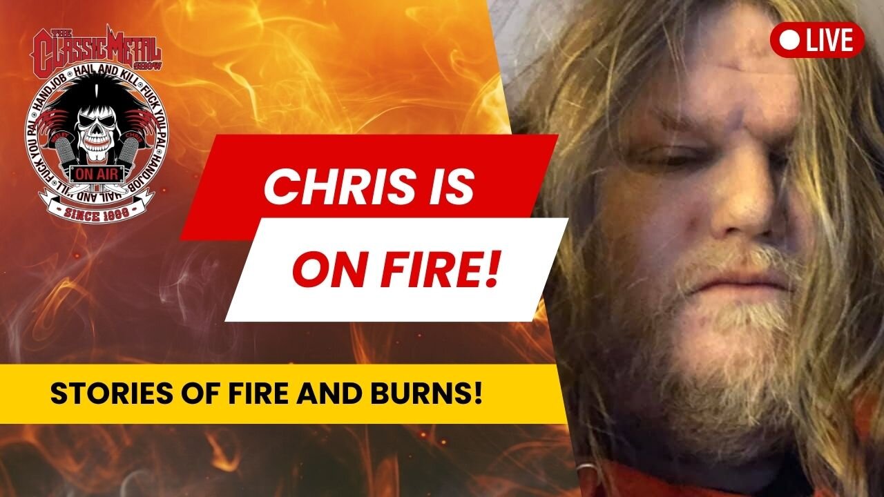 CMS Highlight | What Chris Remembers About His Burn Accident!