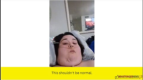 This shouldn't be normal.