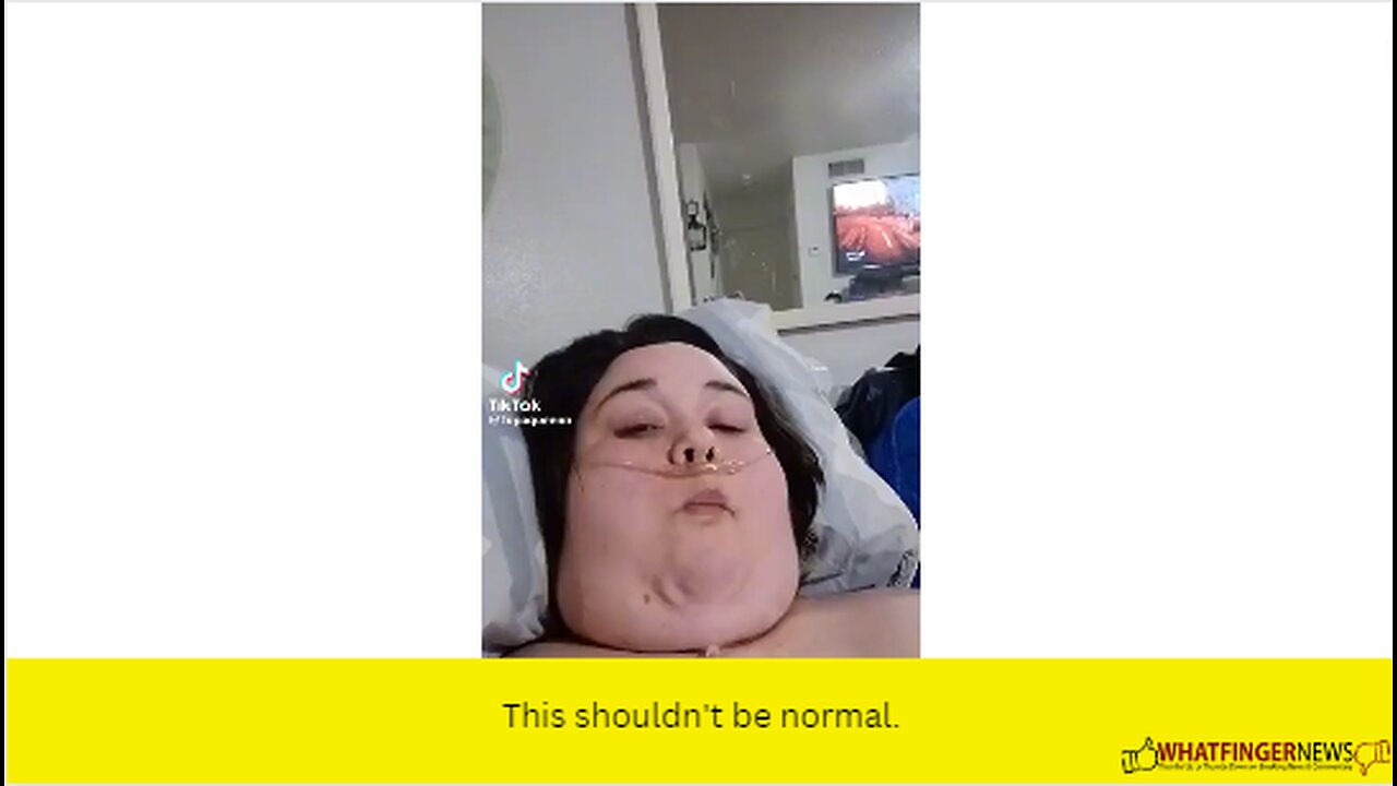 This shouldn't be normal.