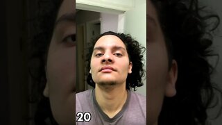 EVOLUÇÃO 3 SEMANAS USANDO MINOXIDIL