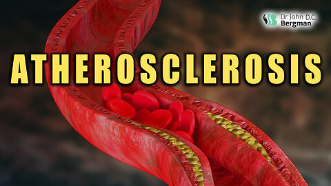 Solutions for Atherosclerosis