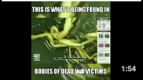 This is what is being found in the bodies of dead VAXX victims