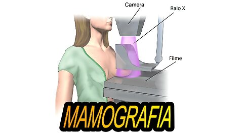 WHAT IS MAMMOGRAPHY? And when should you have a mammogram?