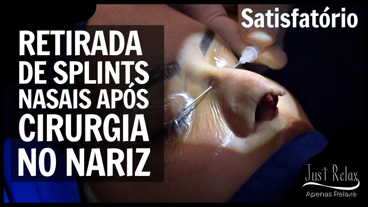 Retirada do Splint Nasal Cateter Aerador #03 Satisfatório - Asmr - Just Relax | Apenas Relaxe