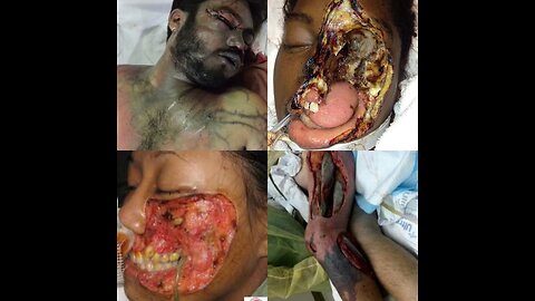 Newly Created And Deadly Pestilences Around The World
