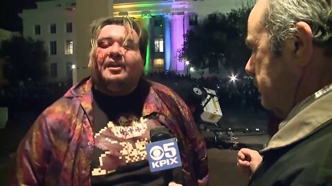 Eddy Brock a Trump Supporter Attacked At UC Berkley America is Trump