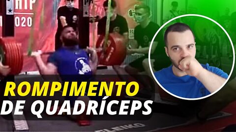 Rompimento de quadríceps no Agachamento | Por quê ocorre e como evitar?