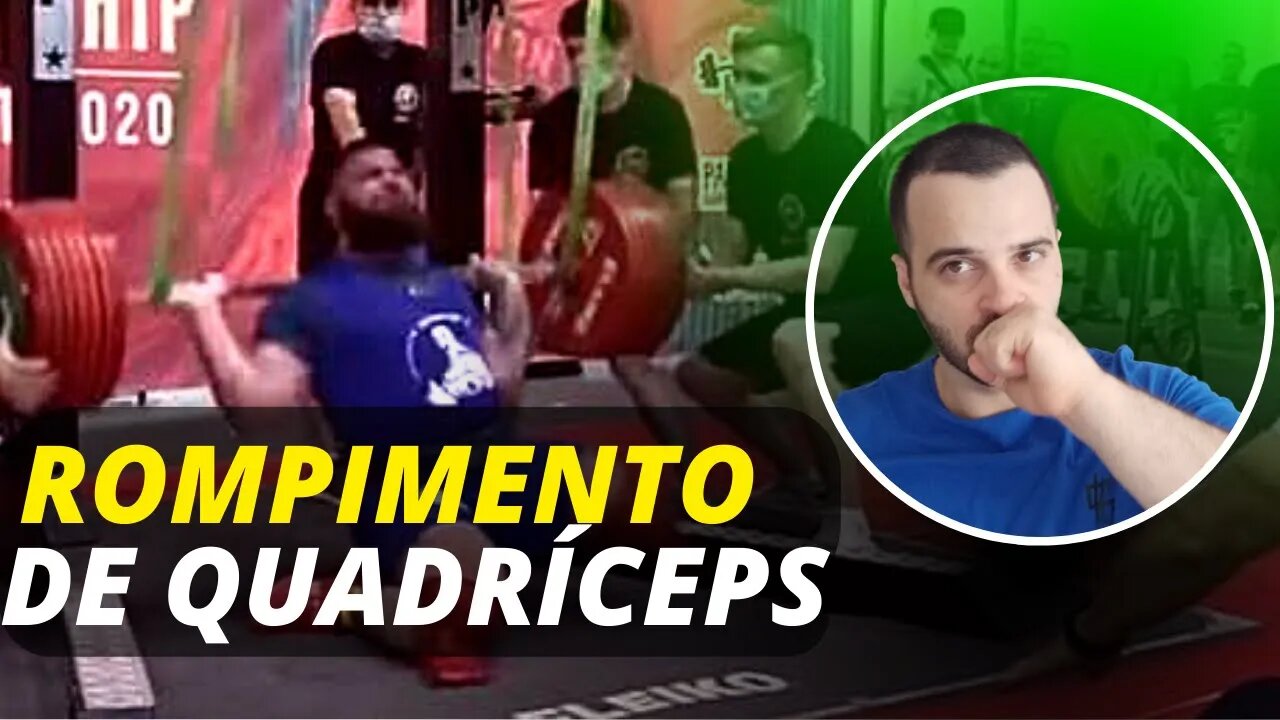 Rompimento de quadríceps no Agachamento | Por quê ocorre e como evitar?