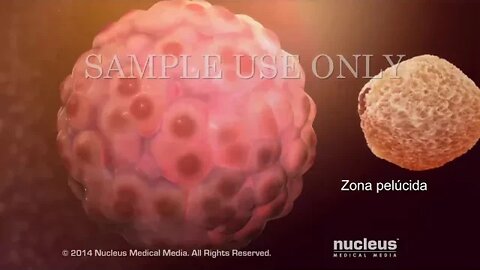 Fertilización in vitro