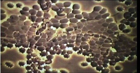 DR. ANDREAS KALCKER ON HOW CDS HELPS REVERSE VACCINE-TRIGGERED BLOOD CLOTTING
