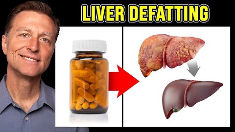 The BEST Vitamin to Cleanse a Fatty Liver - Dr. Berg