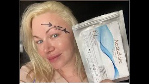 Can PCL Threads Stimulate Hair Growth? | Code Jessica10 saves you $$$