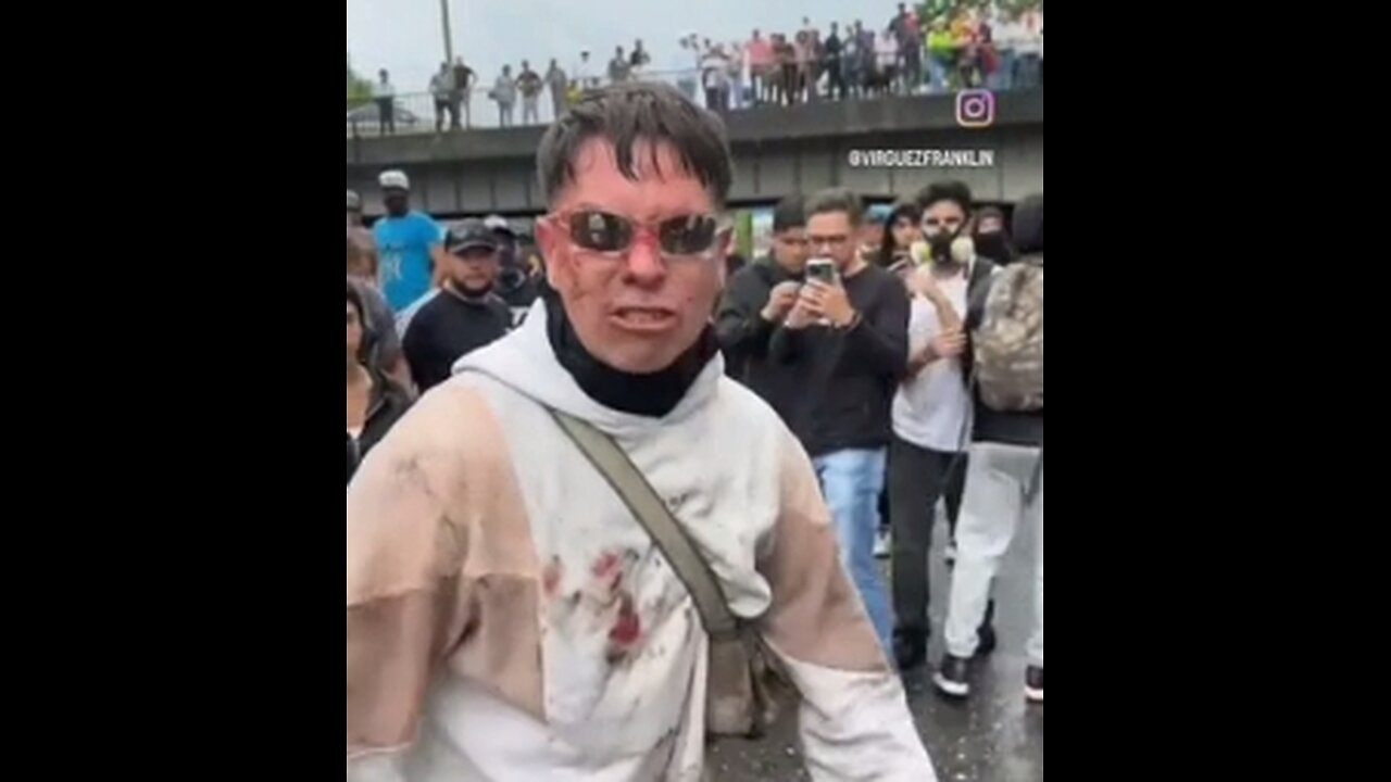 Maduro colocou seus homens para agredir a população. Uma caminhonete prata atropelou pessoas que protestavam.