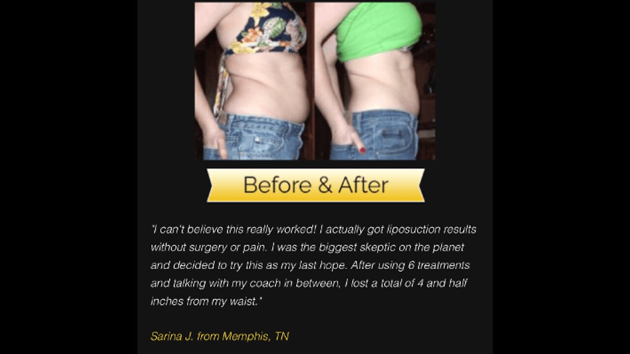 Liposuction Alternative: All Natural Good Effective Liposuction Alternative