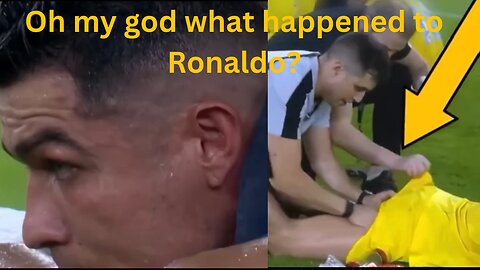 Oh my God what happened to Ronaldo?