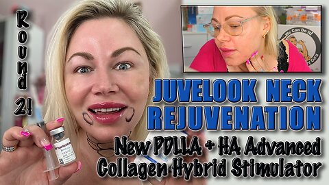 JuveLook Neck Rejuvination, PLA + HA Collagen biostimulator! AceCosm.com code Jessica10 saves