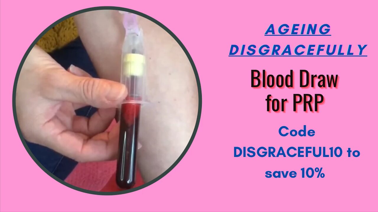 How to do a blood draw for PRP & PRF