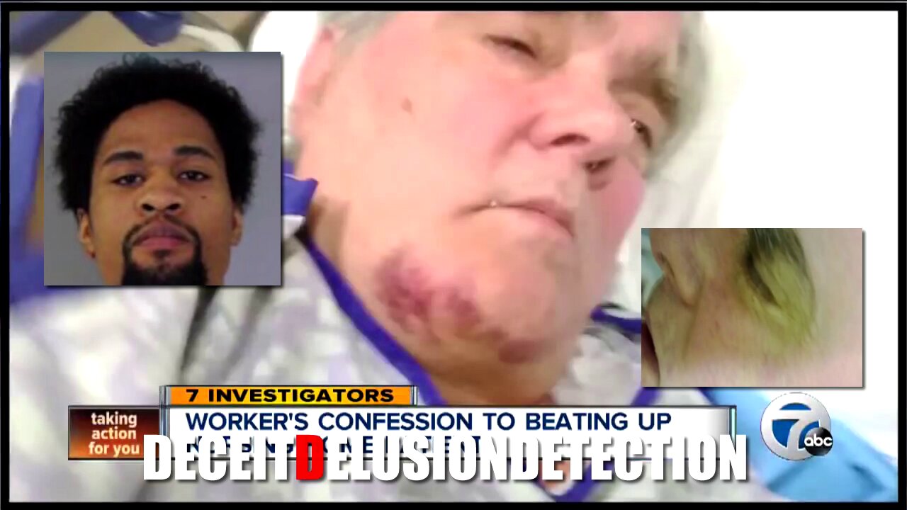 A black nursing home employee beats up a white male patient