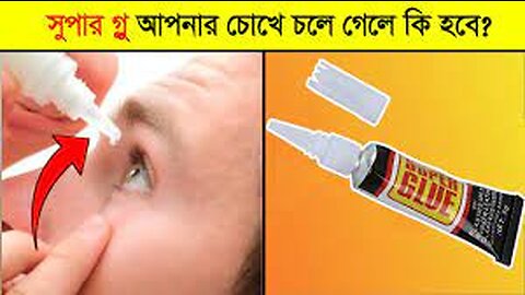 কী হবে যদি সুপারগ্লু আপনার চোখের ভেতর চলে যায় ? What If Superglue Goes Inside The Eyes