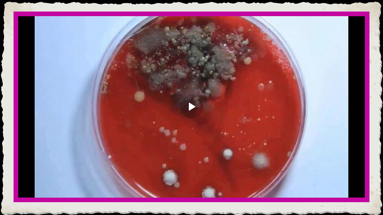 Germ theory hypothesis has failed for over a century TB is one example among many