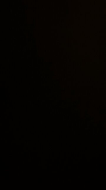 Caught my finger in the metal part of a jacket