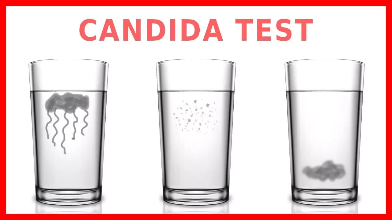 Do You Have Candida? Take The "Spit Test"!