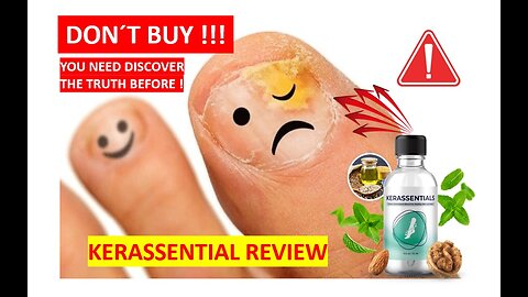 Kerassentials [Really Work?] Kerassentials Review ⚠️ Kerassentials Nail Fungus ⚠️ Kerassentials 2023