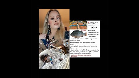 (PRAY OVER YOUR FOOD JAKE) Woman's Limbs Gets Amputated After Eating Tilapia