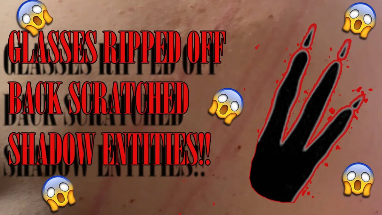 Entity Rips Glasses Off, Scratches Back and Peeks Around Corners. 😱