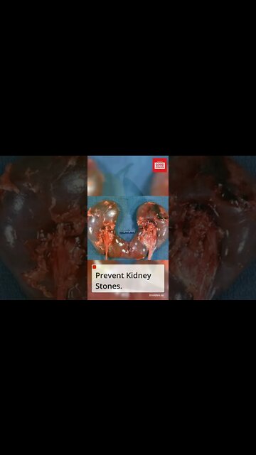 6 Health benefits of lemon #shorts