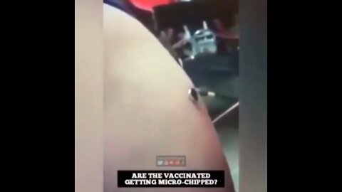 Magnets are sticking to the site of injections ...