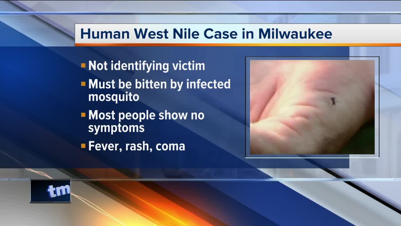 First human case of West Nile confirmed in MKE