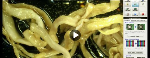 COVID Vax Contains Nanoparticles That Colonize the Body