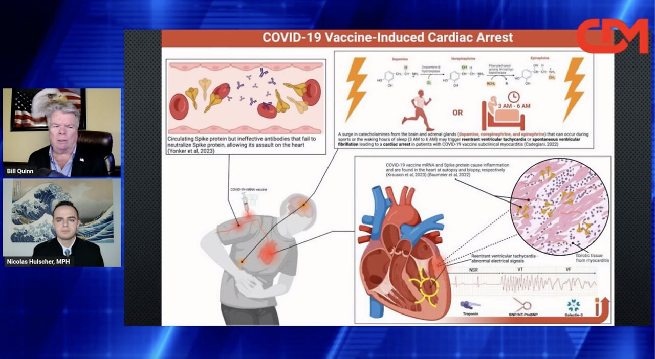Study Reveals 1,236% Surge in Excess Cardiac Arrest Deaths Among 2 Million Vaccinated Individuals