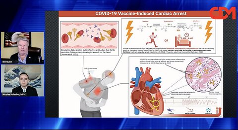 Study Reveals 1,236% Surge in Excess Cardiac Arrest Deaths Among 2 Million Vaccinated Individuals