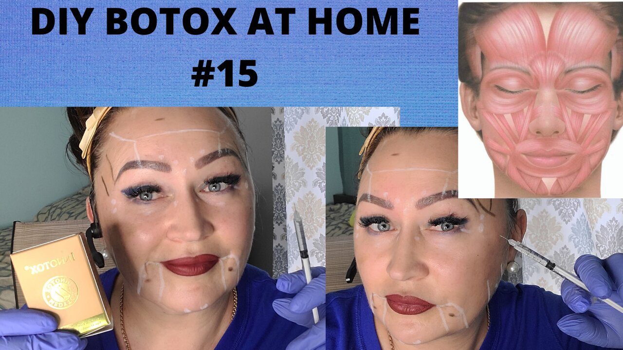 Botox Full face @ HOME with INNOTOX! VLOG# 15 #BOTOX #innotox 3. 27. 21