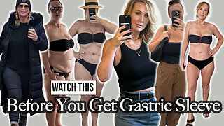 Watch This Before you Have Gastric Sleeve Surgery - 4 Month Update - Before & After Photos