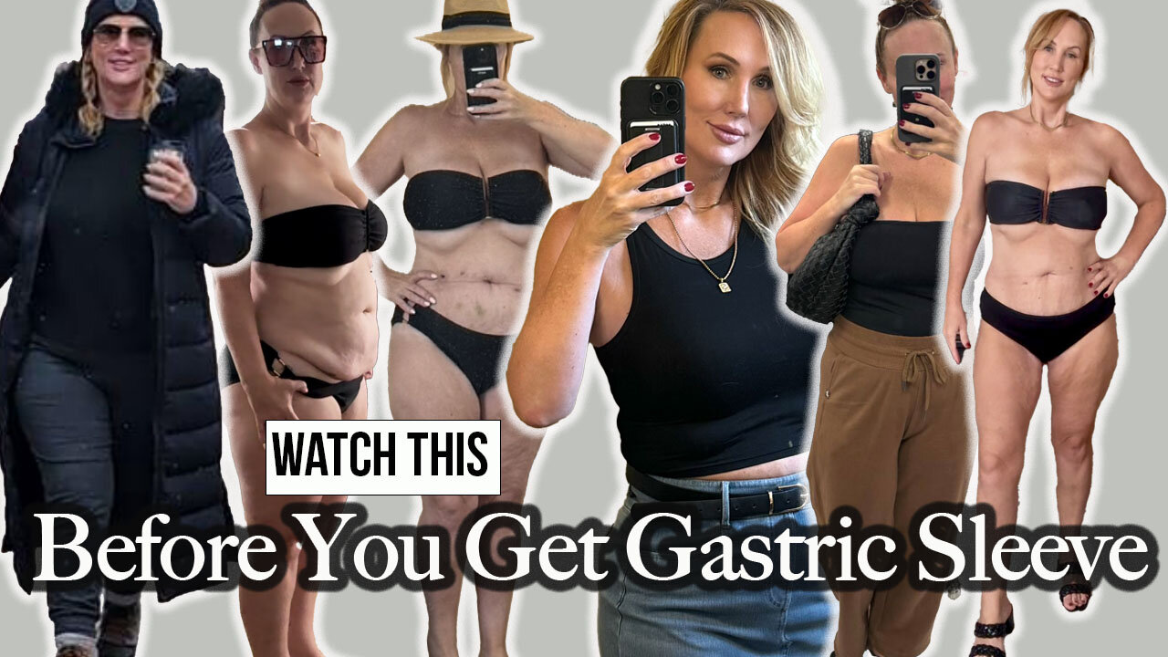 Watch This Before you Have Gastric Sleeve Surgery - 4 Month Update - Before & After Photos