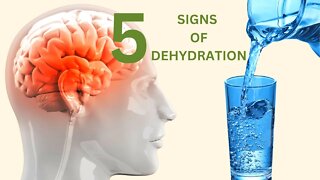 5 SIGNS OF DEHYDRATION You Didn’t Know- watch this! BloomWithLor