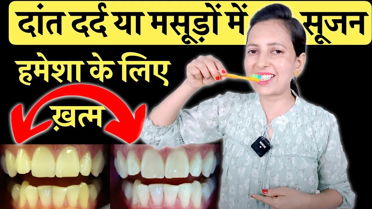 दांतों का दर्द मसूड़ों की सूजन का घरेलू देसी इलाज | Cure Tooth Ache Swollen Gums, Tooth Decay