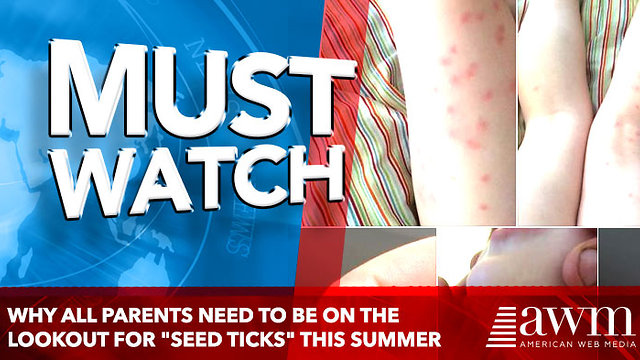 Why All Parents Need to Be on the Lookout for "Seed Ticks" This Summer