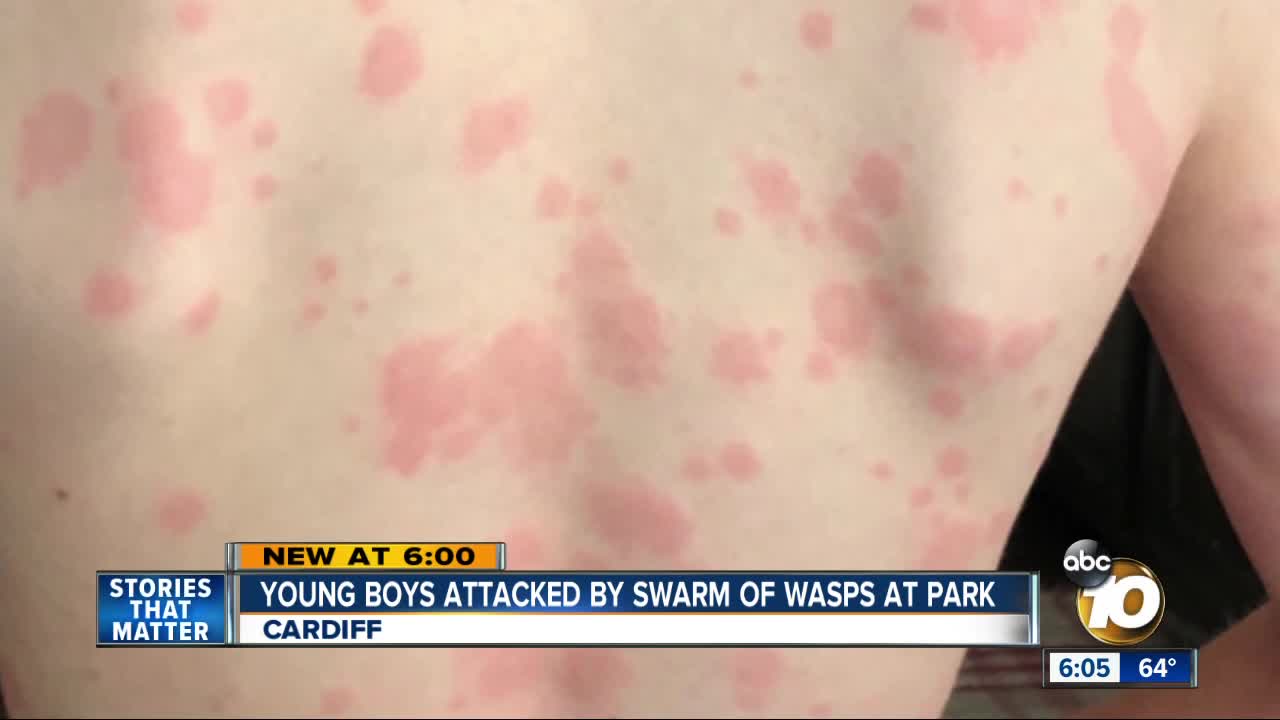 Young boys stung by wasp swam at North County park