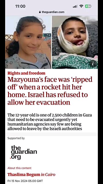 Platinum in victim's face falling apart, causing agony, unable to eat or speak due to shrapnel.⏬Desp