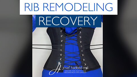 Rib Remodeling Recovery