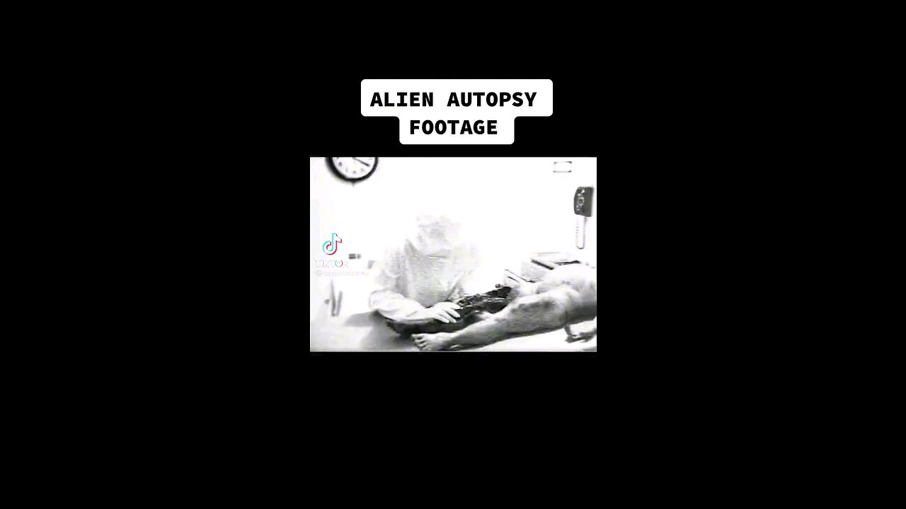 alien autopsy