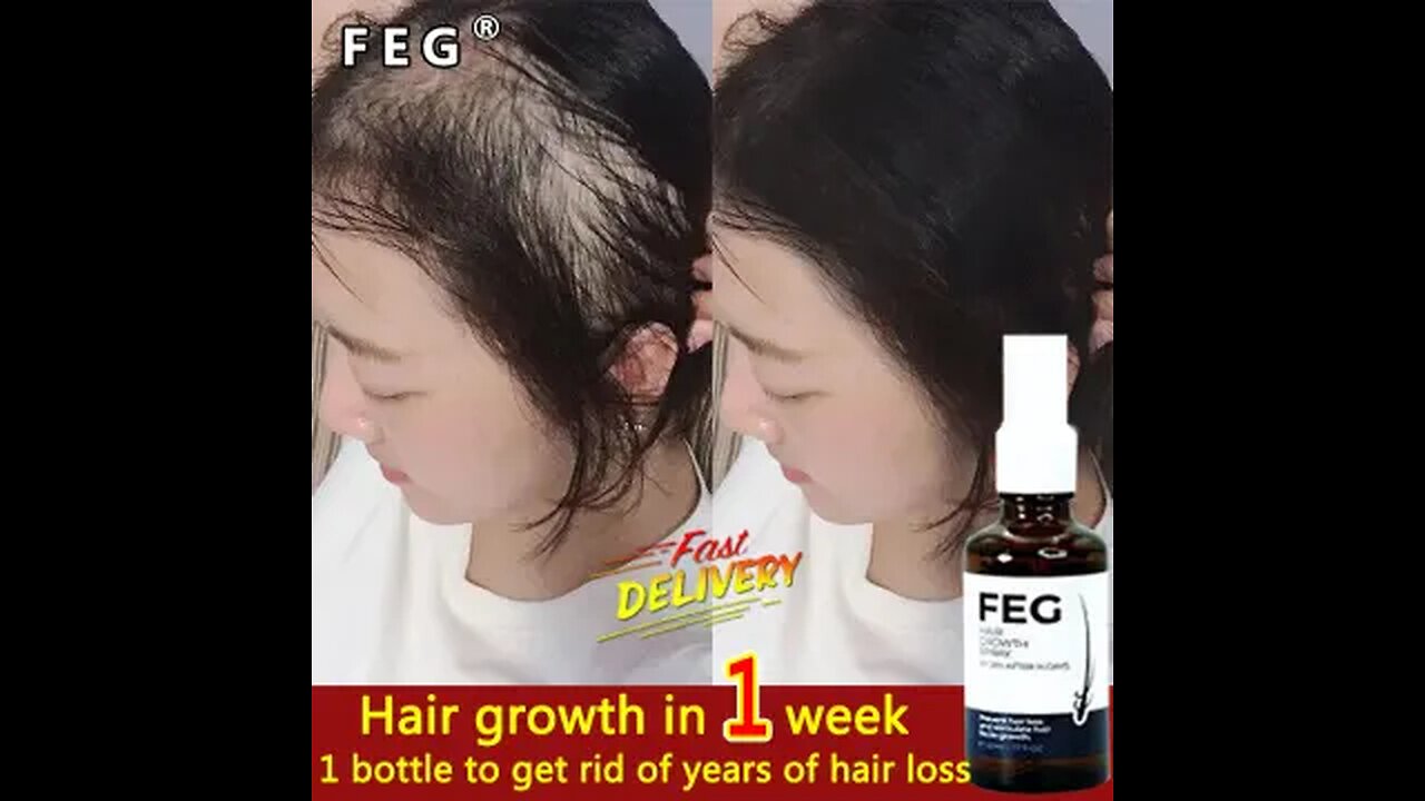 "FEG: The Hair Growth Solution Everyone's Talking About!"